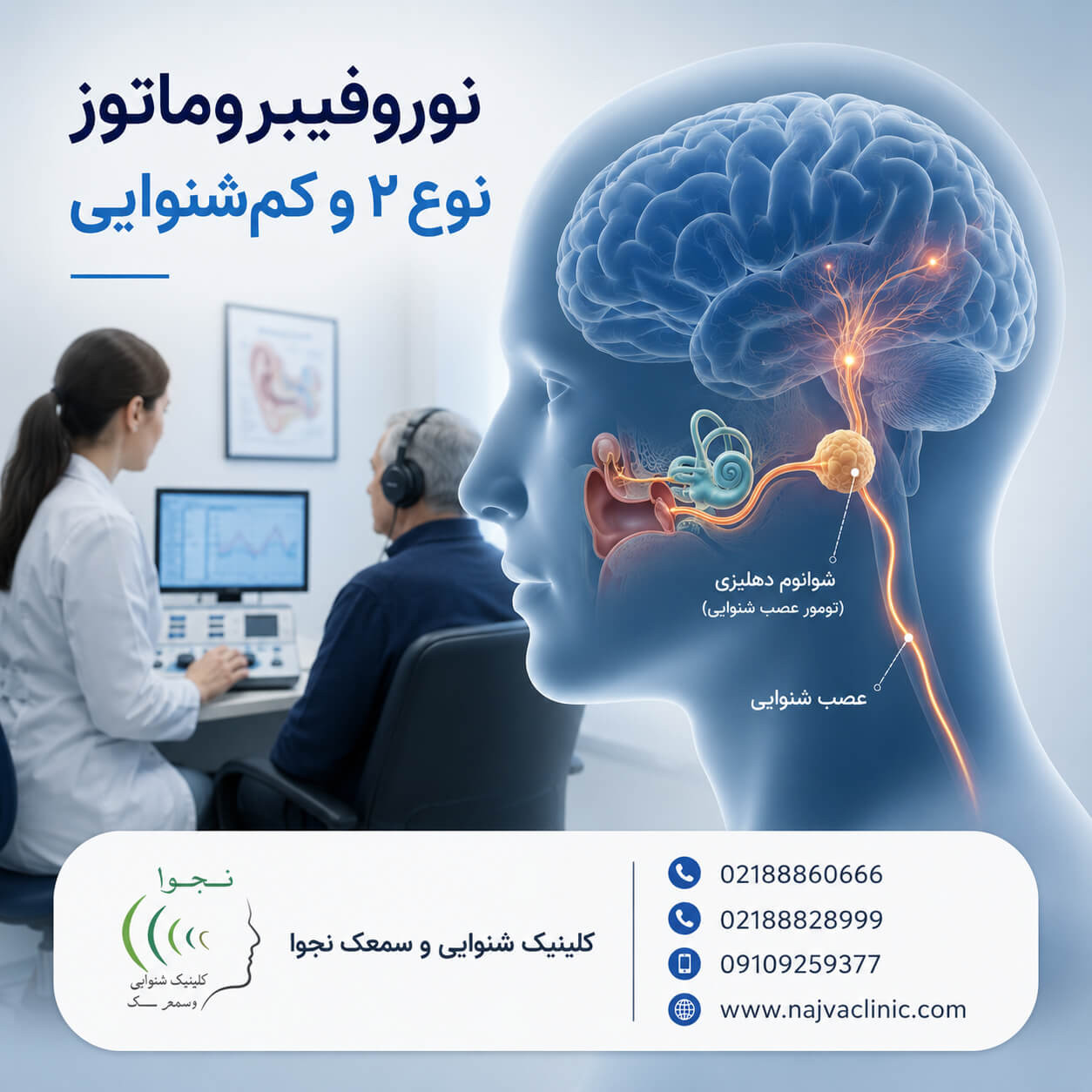 نوروفیبروماتوز نوع ۲ و کاهش شنوایی